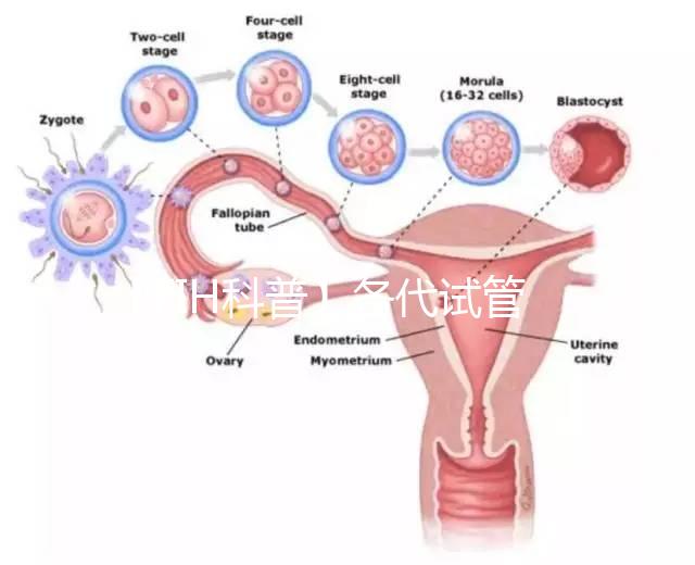 【FIH科普】各代試管嬰兒技術(shù)的比較