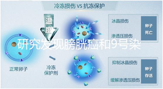 研究發(fā)現(xiàn)膀胱癌和9號(hào)染色體缺失有關(guān)系！