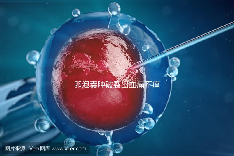 卵泡囊腫破裂出血痛不痛？經歷過的姐妹們給出回應