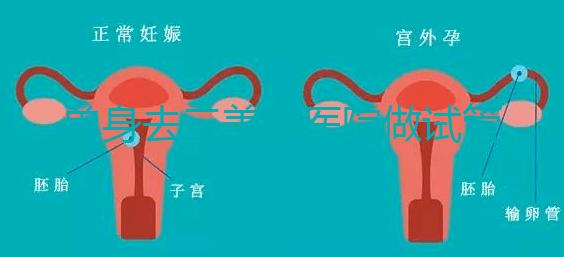 單身去三美泰醫(yī)院做試管需要花費(fèi)多少錢？費(fèi)用明細(xì)是怎么樣的