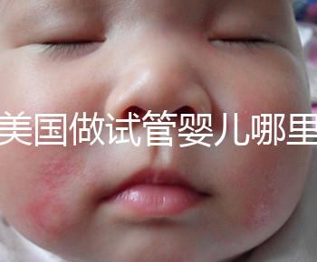 去美國做試管嬰兒哪里最好，4家好評輔助生殖機構推薦