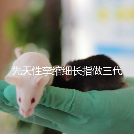 先天性攣縮細(xì)長(zhǎng)指做三代試管嬰兒能避免遺傳嗎