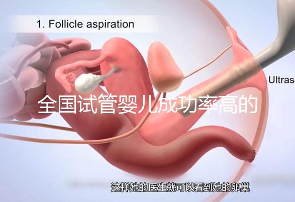 全國試管嬰兒成功率高的醫(yī)院有哪些?(全國試管嬰兒成功率高的醫(yī)院目錄一覽)