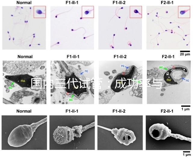 國內(nèi)三代試管:成功率與費(fèi)用全知曉?