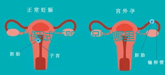 人保試管嬰兒保險哪里能買、怎么買速覽，一篇看懂不踩坑