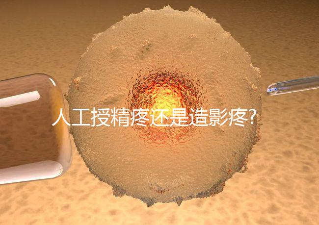 人工授精疼還是造影疼?被瞎對比，二者疼痛不是一個等級