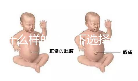 什么樣的情況下選擇做試管嬰兒？