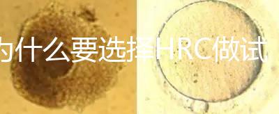 為什么要選擇HRC做試管？這6大優勢看完就知道答案