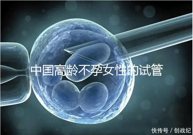 中國高齡不孕女性的試管嬰兒指南，8個方面5條推薦意見