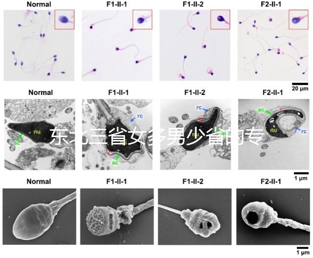 東北三省女多男少省的專業(yè)解讀原因1:1真沒開玩笑