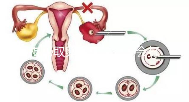 揭秘取卵后醫(yī)生會不會打電話問選幾代？這些問題會涉及到