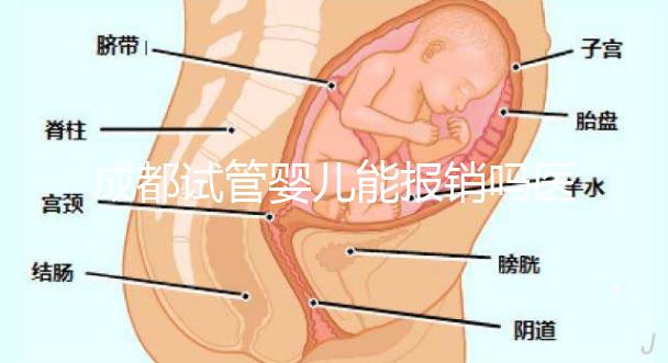 成都試管嬰兒能報銷嗎醫保？政策解讀