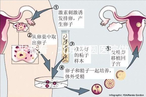 來看看，北京家圓醫院做三代試管費用總共多少？