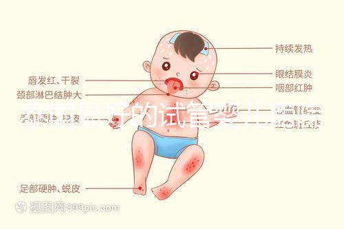 泰國(guó)最好的試管嬰兒醫(yī)院是哪家？公布最新前十名