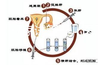 浙江27家試管嬰兒醫院成功率排名公開，邵逸夫醫院位居前十