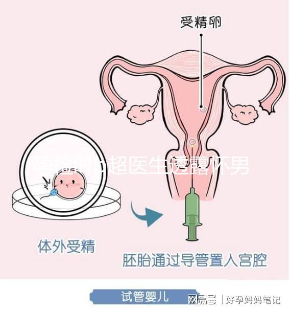 孕檢時(shí)b超醫(yī)生透露懷男寶女寶暗語(yǔ)寶典，一語(yǔ)戳中有心人！