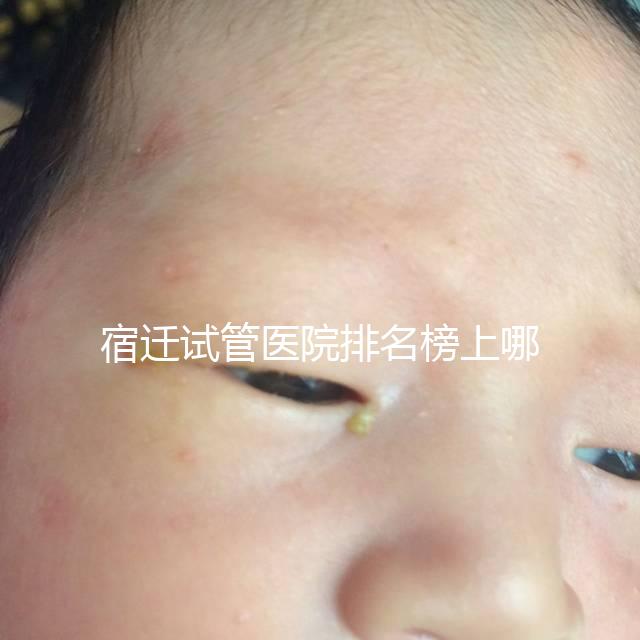 宿遷試管醫院排名榜上哪家好，不造助孕成功率和費用別亂選