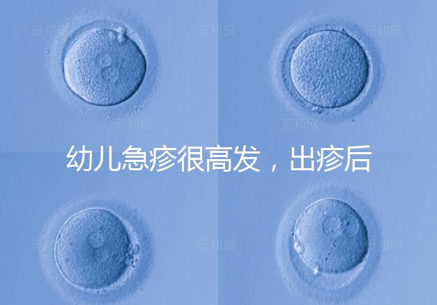 幼兒急疹很高發，出疹后的護理方法及注意事項提前知曉！