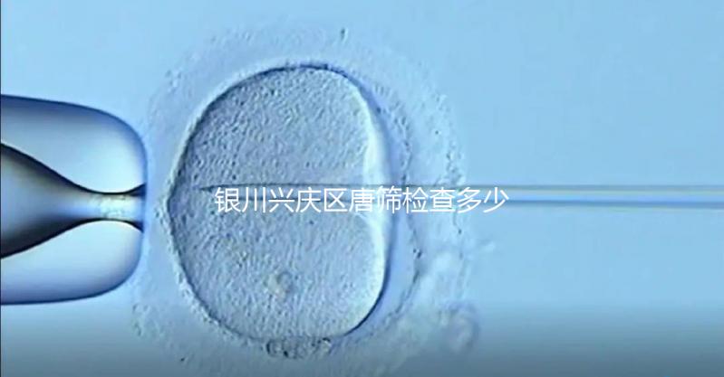 銀川興慶區(qū)唐篩檢查多少錢取決于情況，2024年國家免費限額