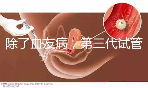 除了血友病，第三代試管嬰兒技術(shù)(PGD)還能篩查什么疾病？