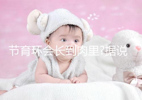 節(jié)育環(huán)會(huì)長(zhǎng)到肉里?據(jù)說(shuō)這是有一定依據(jù)的