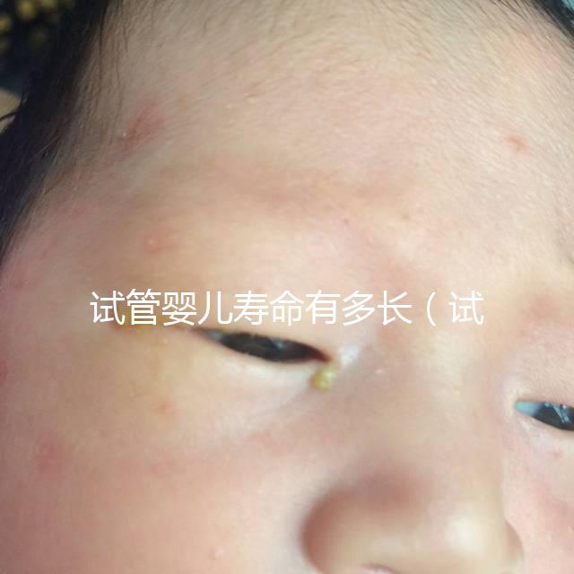 試管嬰兒壽命有多長(試管嬰兒壽命有多長時(shí)間)