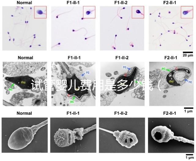 試管嬰兒費(fèi)用是多少錢(qián)（試管嬰兒費(fèi)用是多少錢(qián)一次）