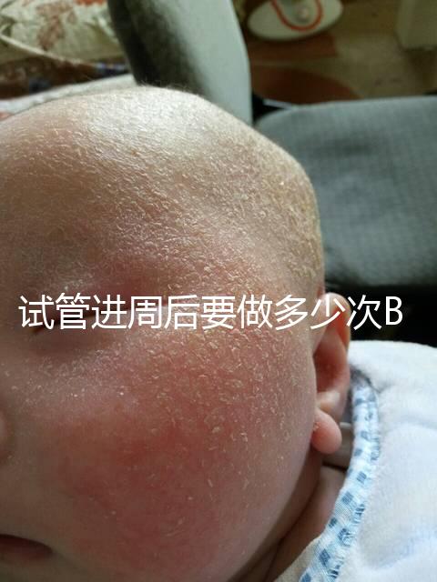 試管進周后要做多少次B超？需要檢查什么？進來看看