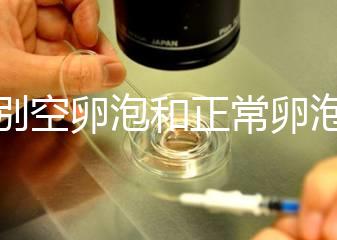 辨別空卵泡和正常卵泡是有技巧的，只需要了解這四個方面就可以輕松辨別，快速學習！