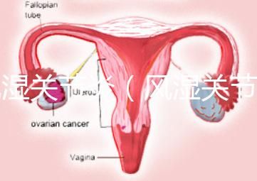風濕關節炎(風濕關節炎的癥狀有哪些)