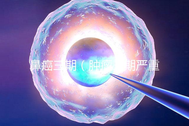 鼻癌三期(腫瘤三期嚴重嗎)