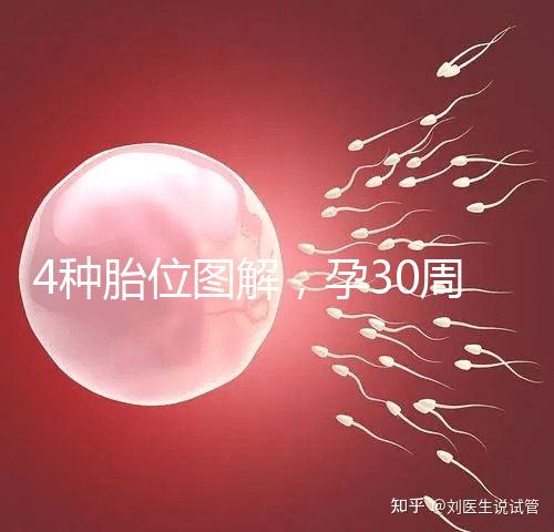 4種胎位圖解，孕30周這個姿勢最適合順產